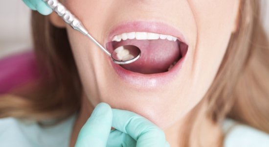 Dentist checking patient's all ceramic dental restoration