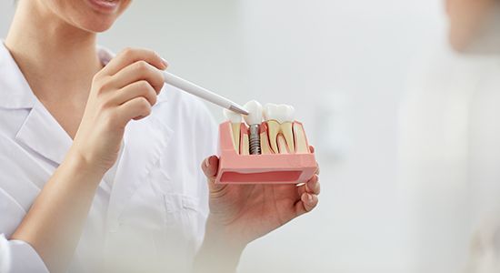 Dentist showing patient a model dental implant supported replacement tooth