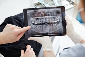 Patient and dentist reviewing X-ray