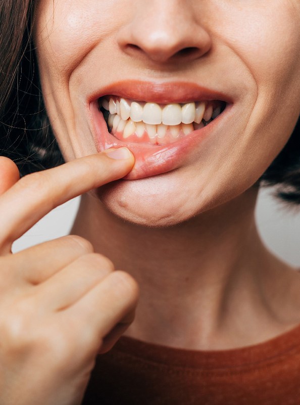 a woman smiling and showing her gums
