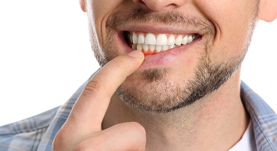 a man pointing at his gum line