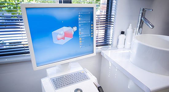 Computer system used to design CEREC same day dental crowns