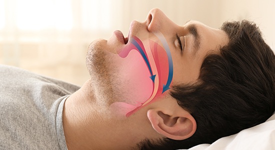 Sleeping man with animated airway over his profile