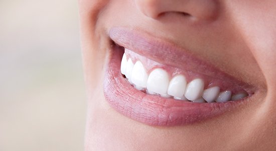 Closeup of brilliant smile after in office teeth whitening