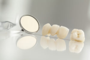 Why would you need to visit your dentist in Powell for a same-day dental crown?