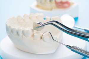 Dental crown being held by instrument.